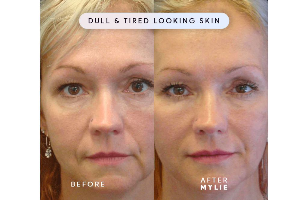 My Facial Plump - Anti-Aging Serum